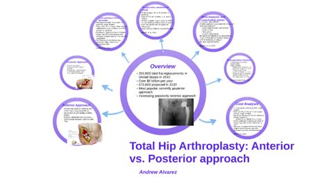 Anterior Vs Posterior Hip Arthroplasty By Andrew Alvarez
