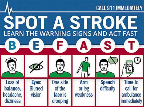 How To Recognize And Respond To A Warning Stroke Harvard Health