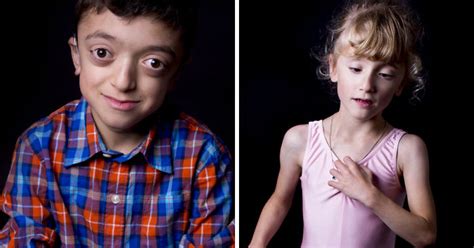 I Photograph Children With Rare Diseases To Encourage People To Look