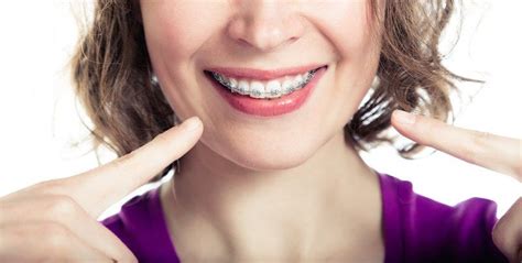 Surprising Benefits Of Braces Treatment For Adults By Amd Dental Clinic Medium