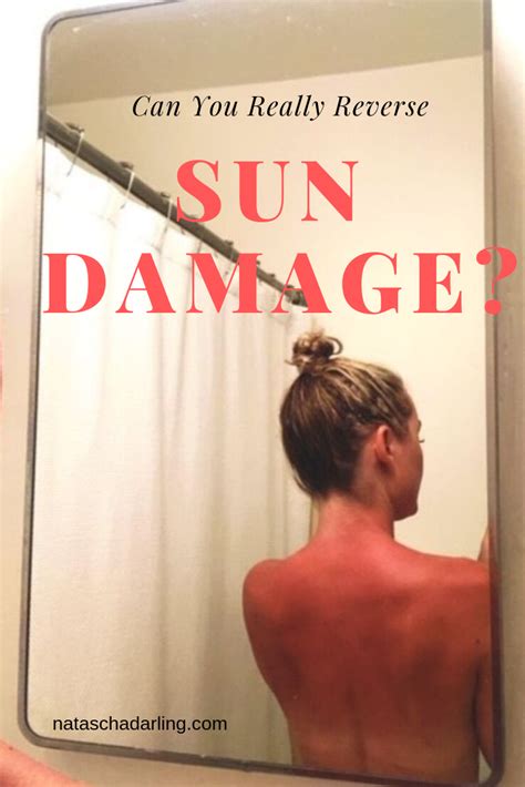 Can You Really Reverse Sun Damage Natascha Darling Sunburn You