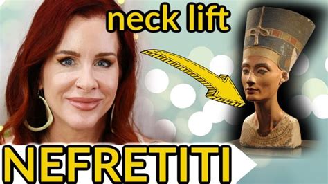 My 1st Nefertiti Neck Lift With Anti Wrinkle Injections Non Surgical