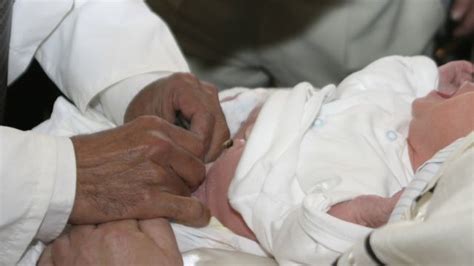 Es posible revertir la circuncisión BBC News Mundo