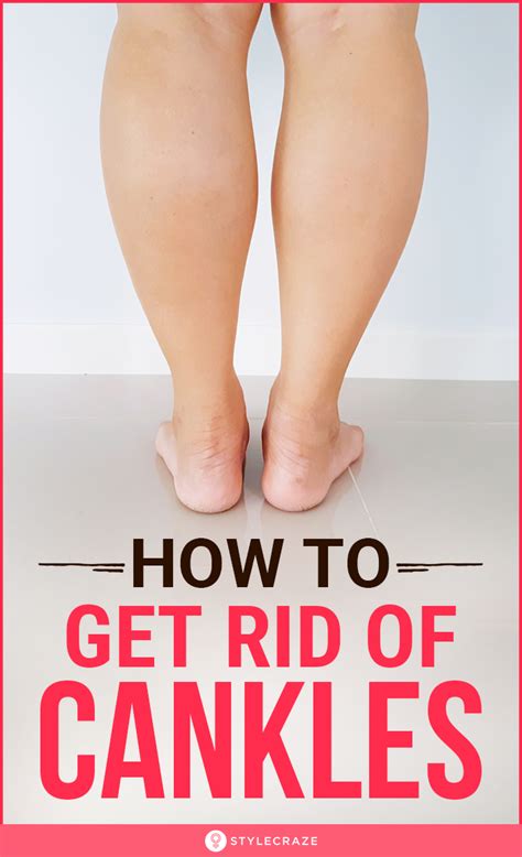 Say Goodbye To Cankles With Effective Exercises