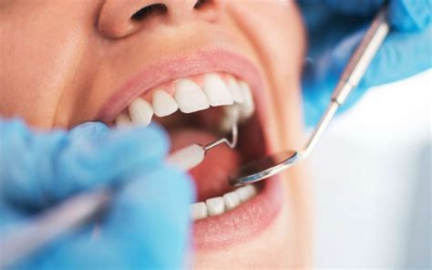 📍 ¿qué Es Un Curetaje Dental Clínica Dental Veracruz En Móstoles