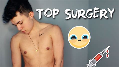 Ftm Top Surgery 2 Years Post Op Youtube