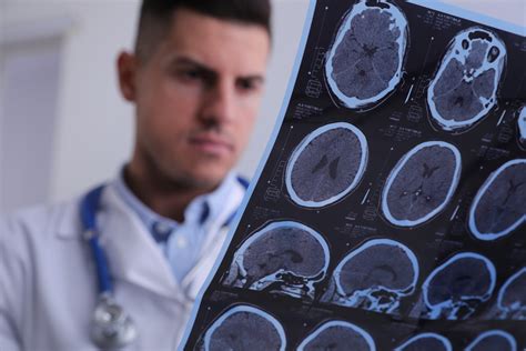 The First Steps In Diagnosing A Traumatic Brain Injury Advantage