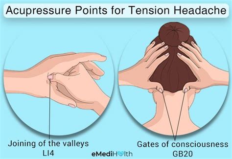 How To Manage Tension Headaches At Home Emedihealth Tension Headache Relieve Tension