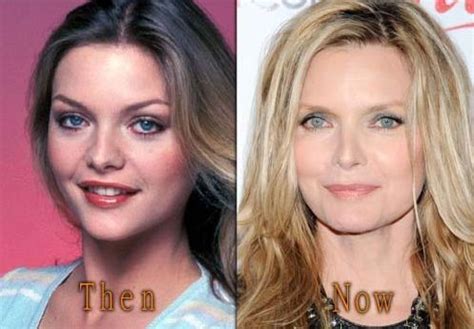 Michelle Pfeiffer Before And After Plastic Surgery Celebrity