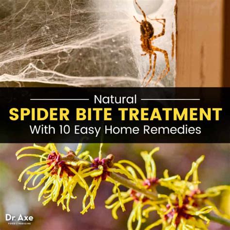 Spider Bite Treatment 10 Natural Home Remedies Dr Axe
