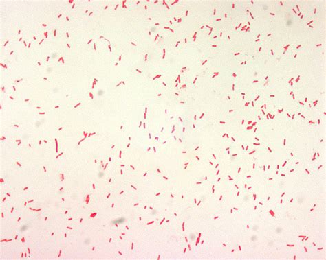 Free Picture Yersinia Pestis Gram Negative Bacillus