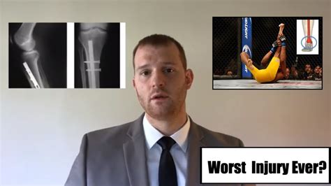 Anderson Silva Breaks Leg Ufc 168 Physical Therapist Reaction Youtube