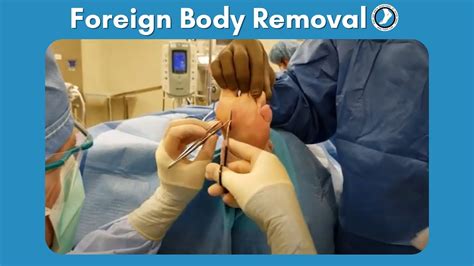 Foreign Body Removal Surgery Youtube
