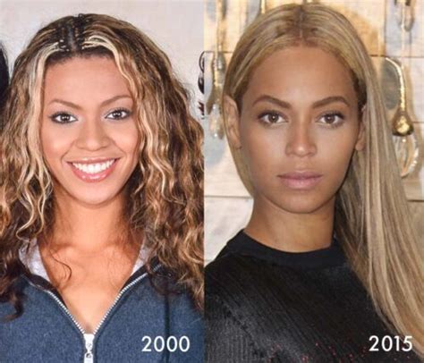 Has Beyoncé Had Cosmetic Surgery Mya Cosmetic Surgery