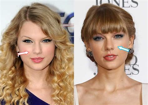Did Taylor Swift Get Plastic Surgery Before After Photos