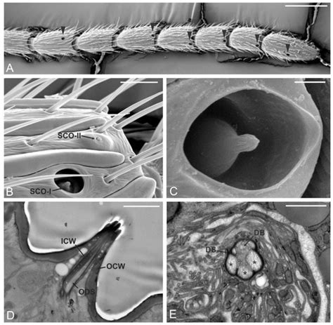 Insects Free Full Text Fine Morphology Of Antennal And Ovipositor Sensory Structures Of The
