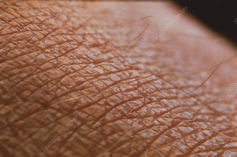 Skin Surface Stock Image P710 0120 Science Photo Library