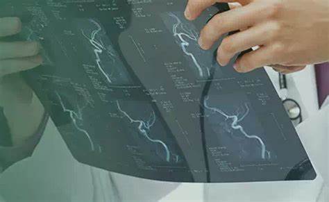 Диета с раком сигмовидной кишки Рак сигмовидной кишки: симптомы, стадии, прогноз, выживаемость Рак сигмовидной кишки: симптомы, стадии, прогноз, выживаемость Диета с раком сигмовидной кишки