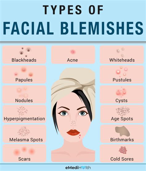 Facial Blemishes Causes Types And Treatment Emedihealth