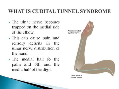 Cubital Tunnel Syndrome Causes Symptoms Diagnosis And Treatment