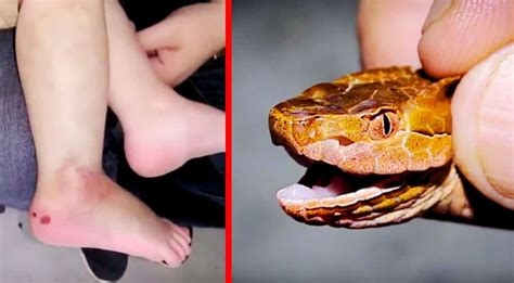 Venomous Copperhead Snake Bites Year Old Boy In South Carolina