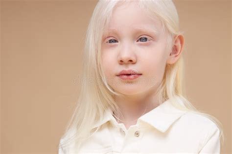 Albino Kid Girl With White Skin And White Hair Isolated Stock Image Image Of Beauty Eating