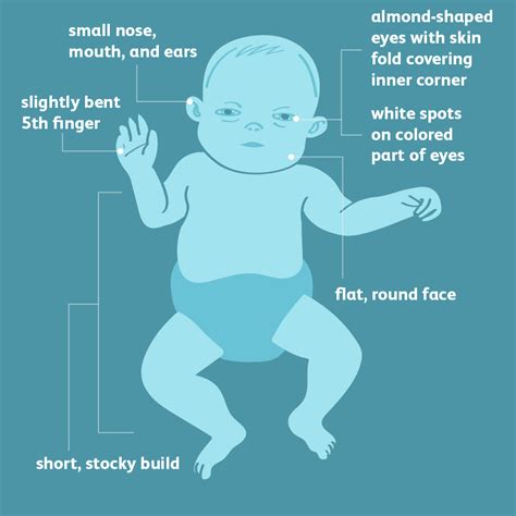 What is Down Syndrome? – AnthosHouse gambar png