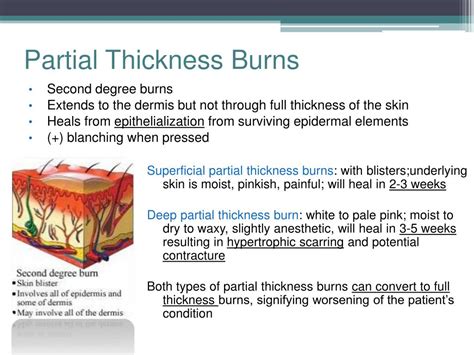 Ppt The Burn Manual Powerpoint Presentation Free Download Id2221837