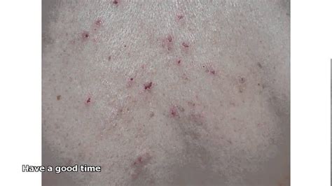 Common Skin Rashes Itchy
