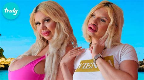 Me And My Girlfriend Get Matching Plastic Surgery Hooked On The Look Youtube