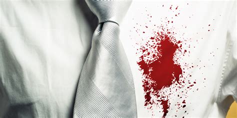Need to learn how to get blood stains out of sheets? How to Remove Blood Stains - Set in Blood Stain Removal