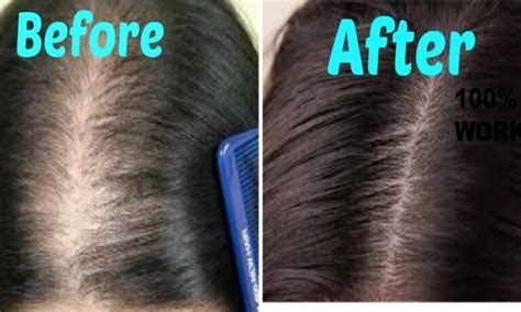 natural shampoo to stop hair loss and stimulate hair growth hoy en belleza