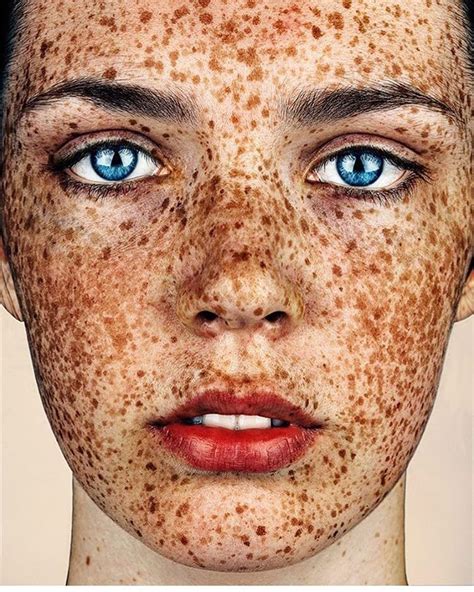 Mrelbank ️ Thepinklemonade Beautiful Freckles Red Hair Freckles Freckles