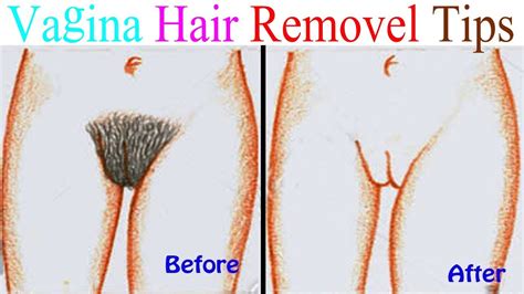 Xxx sex videos vagina shaving tutorial pubic hair removal hard to find, but porn site editor made every effort and found 88231 hd video. How To Remove Vagina Hair Is It Safe To Use Hair Removal ...