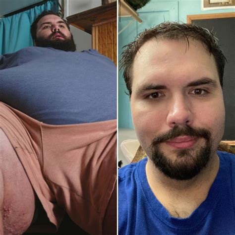 My 600 Lb Life Success Stories See Weight Loss Transformations In Touch Weekly