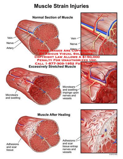 About The Muscular System And The Muscle Injury