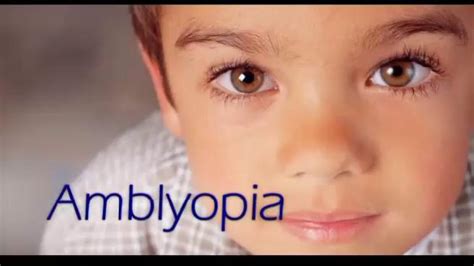 Things You Didnt Know About Amblyopialazy Eye Quickdoc Health