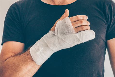 What types of hand injuries do hand specialists see from sports? - Midwest Hand