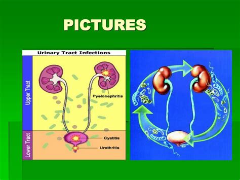 Ppt Urinary Tract Infections Powerpoint Presentation Free Download