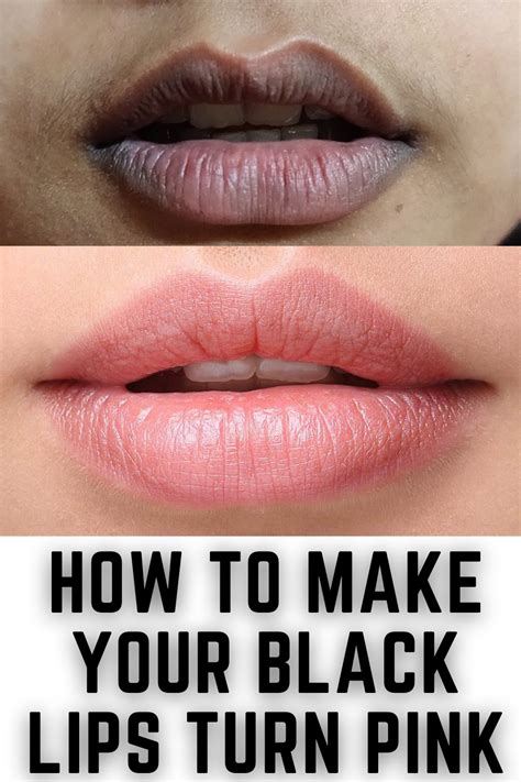 How To Turn Black Lips Into Pink Naturally In 2023 Lip Lightening