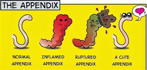 The Burst Of The Appendix What To Look Out For