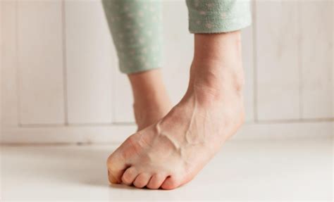 Treatment For Bulging Vein In Legs — Physicians Vein Clinics