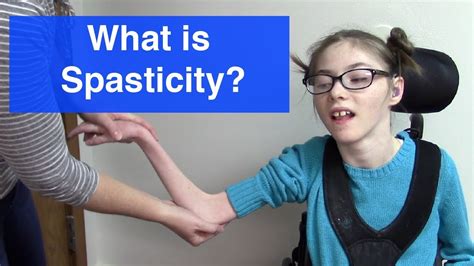What Is Spasticity Youtube