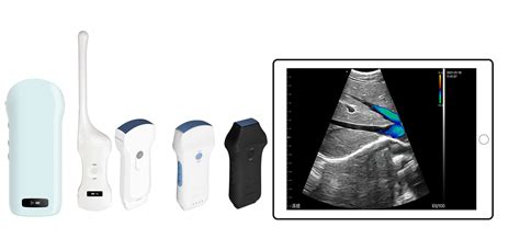 Sonda Ecografica Wireless Specializzata Beijing Konted Medical