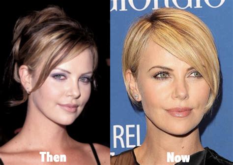 Charlize Theron Plastic Surgery Before And After Photos