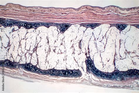 Human Hyaline Cartilage Bone Under Microscope View For Education