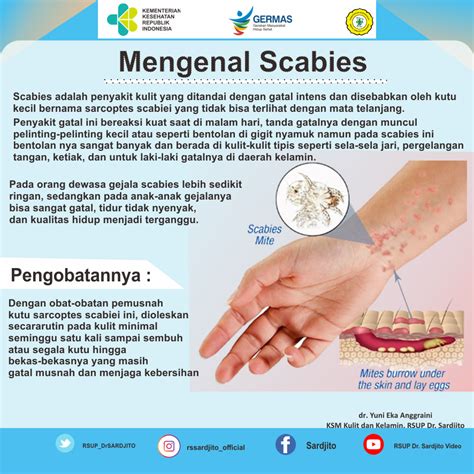 Mengenal Penyakit Scabies Lengkap Dengan Gejala Dan Penyebabnya My Xxx Hot Girl