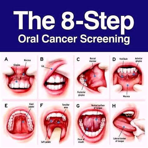 Oral Cancer Screenings Are The Dental Industrys Best Kept Secret