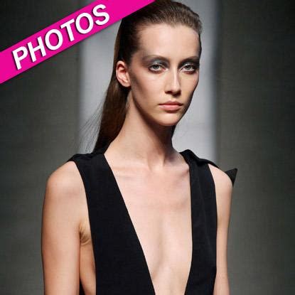 Scary Skinny Model At Milan Fashion Week Creates Controversy