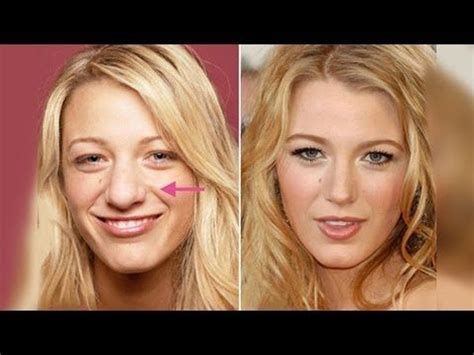 Best Celebrity Nose Jobs In Hollywood Before And After In Blake Lively Plastic